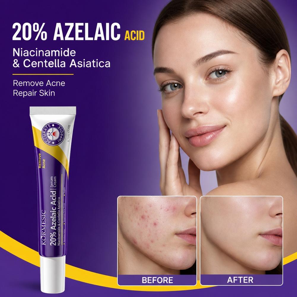 20% Azelaic Acid essence Deep  - đánh giá và giá Luxury Skincare Brands